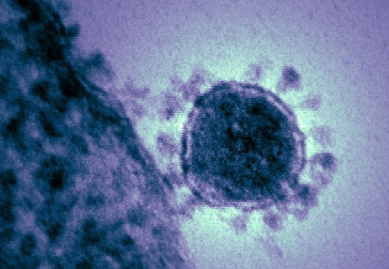 Colorized transmission electron micrograph of the Middle East respiratory syndrome-related coronavirus (MERS-CoV) that emerged in 2012.